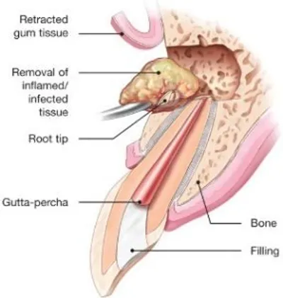 A diagram of the inside of an ear.