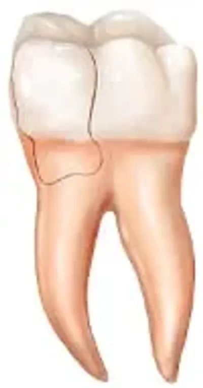 A drawing of the human body shows an area with no visible hair.
