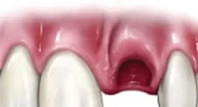 A close up of the mouth and tongue