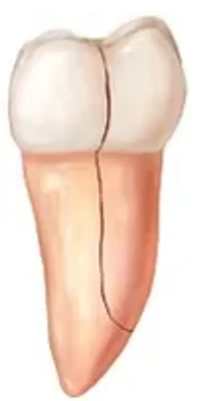 A drawing of the legs and feet of a person.