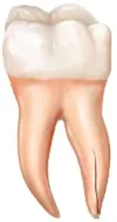 A cartoon of a tooth with no teeth.