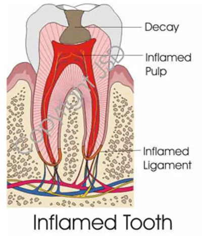A diagram of the inside of an tooth.